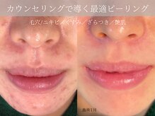 ミューズ バイ エス(MUSE BY S)