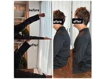 【30代 男性】歩行時の股関節の違和感、姿勢改善でご来店