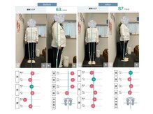 AI診断で細部分析・評価によるあなただけに合わせた施術【整体】