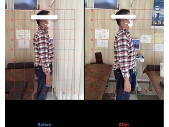 海真堂鍼灸整骨院/反り腰整体