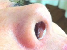 レイジア デイスパ 松本(DaySpa)/鼻毛脱毛　入口、裏側もOK！