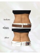 カリス(charis)/Before&After