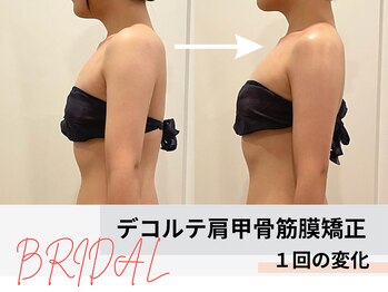 ミルズ(MillS)/デコルテ肩甲骨矯正