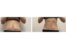 ラナビューティリゾート(Lana Beauty resort)/エステ担当★50代・5きろ減