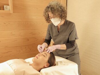 トーリ 代官山(taulli)/前額部への鍼【代官山/鍼灸】