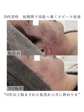 ヴェルシック(Belchic)/今の時代、男性も美肌が絶対条件