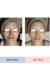 和サロン いろは/圧倒的透明感＆小顔フェイシャル