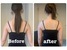 テイクオフ(Takeoff)/整体/姿勢改善/なで肩