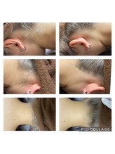 ピリナ(Pilina)/施術