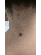 クレビア(CREBIA)/【シミ・シミケア専門店】沖縄県