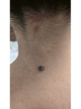 クレビア(CREBIA)/【シミ・シミケア専門店】沖縄県