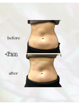 カリス(charis)/Before&After