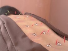 オン 蕨駅西口(ON)/鍼灸【疲労・不調の根本改善】