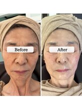 ル ボヌール/月1回で印象劇的変化♪