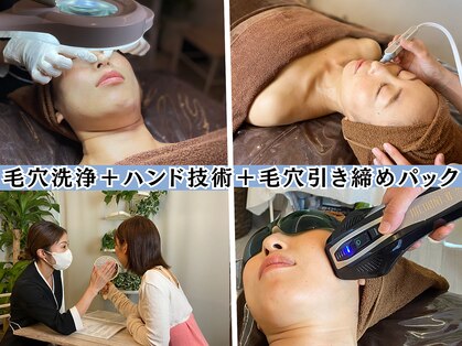 毛穴屋の写真