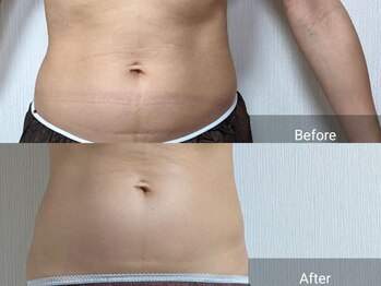 ネイル リリ(nail RiRi)/