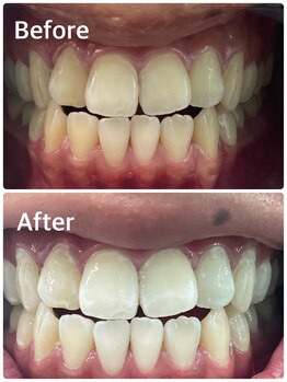 プラチナムビューティー 横須賀店/ビフォーアフター