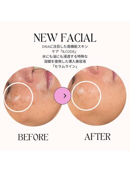 アルバ 広島店(ALBA)/【エイジングケア】エンダ