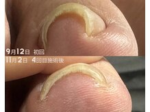 スリーナイン(3Nine)/