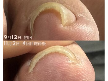 スリーナイン(3Nine)/