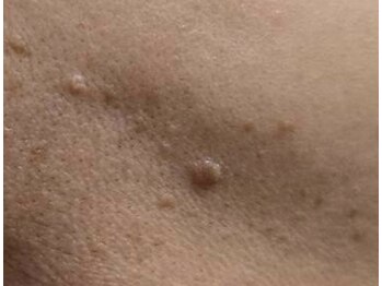 クレビア(CREBIA)/【シミ・シミケア専門店】沖縄県