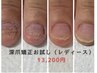 女性【ハンド/深爪矯正】即日見た目が変わる深爪矯正コース☆1回お試し