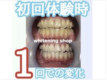 ホワイトニングショップ 亀岡店/初回だけでこの効果！！