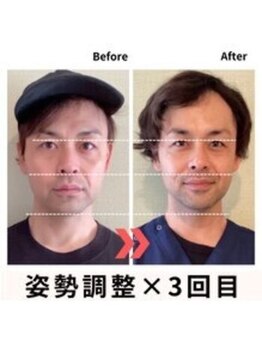 ビーライフ(B Life)/別人レベルに生まれ変われる