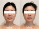 タオ(TAO)の写真/【小顔×ほうれい線×たるみ改善】骨と筋肉に働きかけ、小顔になれるだけでなく若々しい見た目に！