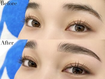 ニコ(Nico)/hollywood brow lift