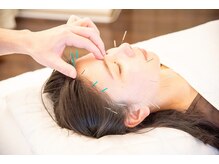 しらゆき堂鍼治療院/美容の様々なお悩みにアプローチ
