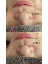 ミィ(miii)/小顔マッサージでたるみゼロへ！