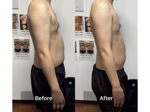 インナーメス(INNER MES)/【上半身】腹ポンを薄いお腹へ