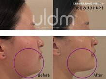 ミラ 中央林間(mira)の雰囲気（国家資格保持[小顔/毛穴/ホワイトニング/ハーブピーリング］）