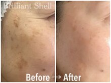 ブリリアント シェル(Brilliant Shell)/次世代スポンジアフェイシャル☆