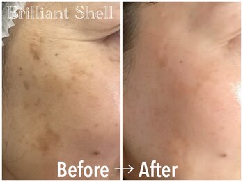ブリリアント シェル(Brilliant Shell)/次世代スポンジアフェイシャル☆