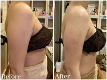 サロンドフェイス(Salon de Faith)/【ブライダル】3回施術♪