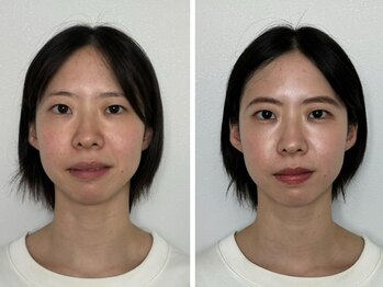 シュシュビエン(Chou Chou Bien)/診断後フルメイク♪