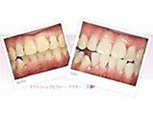 エクシアホワイト 立川南口店/ビフォーアフター