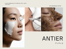 アンティエ