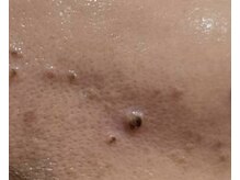 クレビア(CREBIA)/【シミ・シミケア専門店】沖縄県