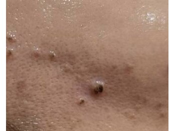 クレビア(CREBIA)/【シミ・シミケア専門店】沖縄県