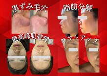 シェリートーキョー 成田店(Cherie Tokyo)