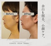 エクラヴィ(Eclatvie)