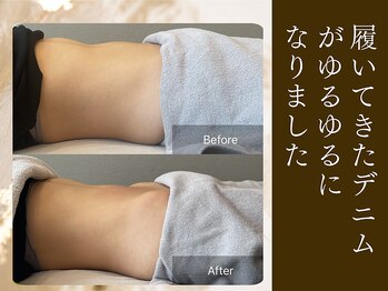 エミフル(emifull)/年々ウエストがきつくなる