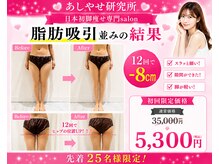 メディカルエステ 大宮店/※痩身症例写真※ 痩身/痩身