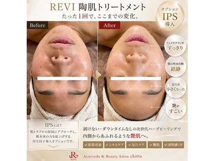アーユルヴェーダサロン チッタ(chitta)の写真