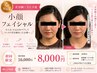【たるみ・むくみ徹底ケア】人気No.2☆美容鍼×ラジオ波 ¥16,000→¥8,000
