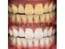 シエル(CIEL)の雰囲気（第一印象は、口元で決まる☆【広島ホワイトニング専門店】）