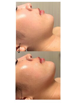 サロンドエムジョリー 横浜(Salon de M jolie)/顔のハリやタルミにお悩みな方!